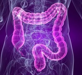 Diagnosi precoce delle lesioni vegetanti, estenosanti del colon retto