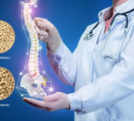 Osteoporosi e M.O.C.: quando è necessario effettuare la densitometria ossea?