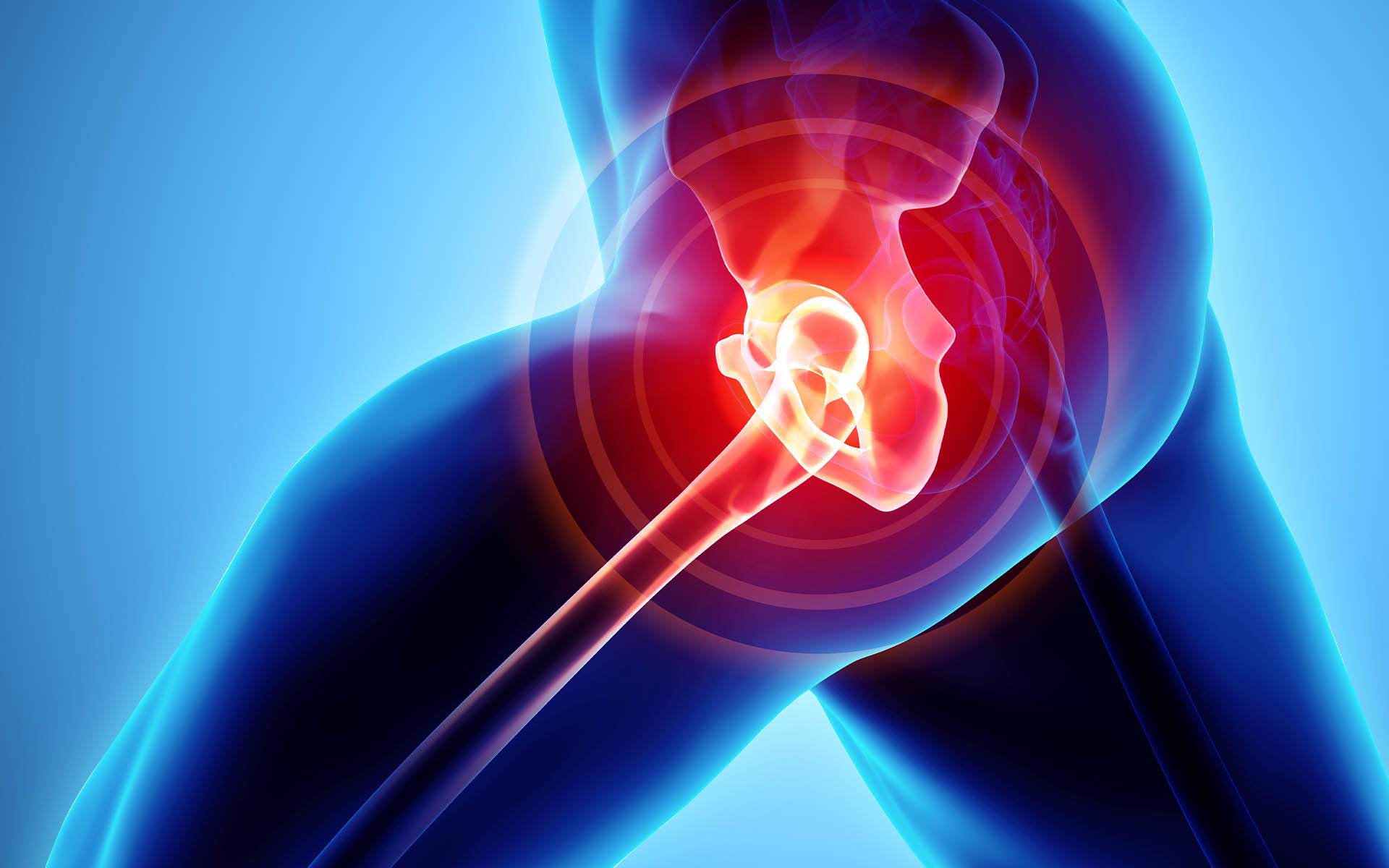 Artrosi e artrite dell'anca