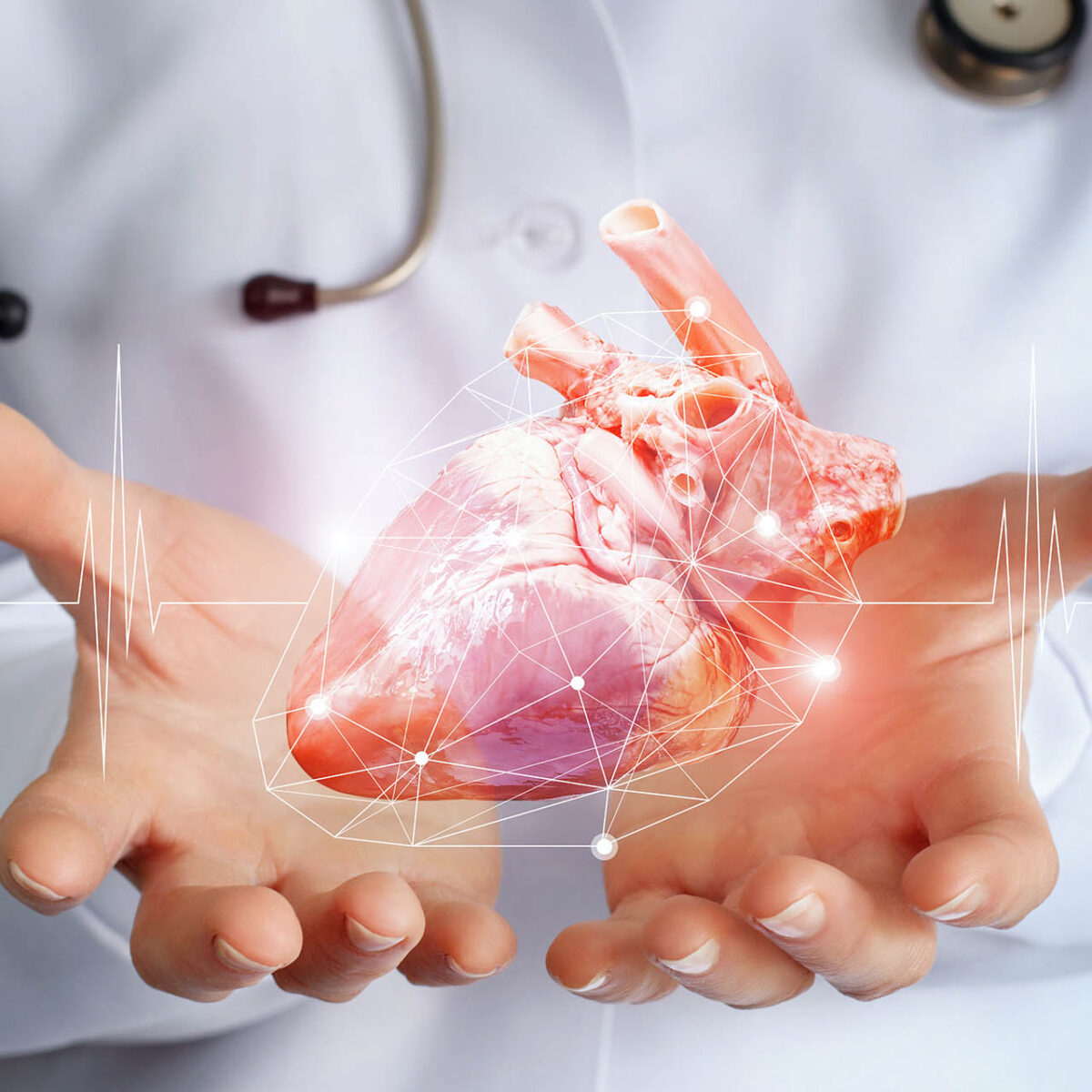 La risonanza magnetica cardiaca per studiare il cuore